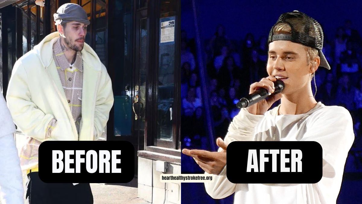 Justin Bieber Weight Loss: 30 Pounds, 6 Months, 175 lbs To 145 lbs