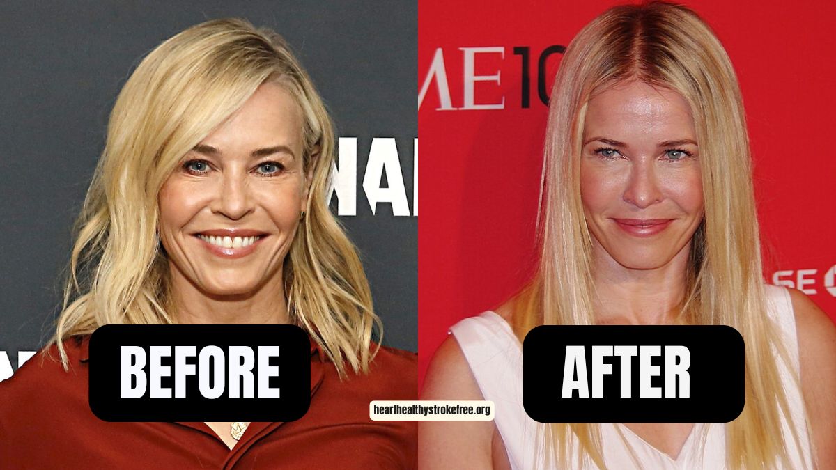 Chelsea Handler Weight Loss: From 145 Pounds To 125 Pounds In 6 Months