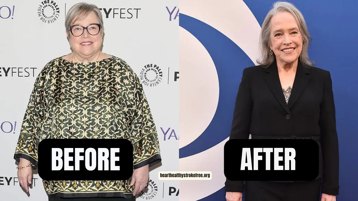 Kathy Bates' Incredible 100-Pound Weight Loss Journey: How She Transformed Her Health And Career