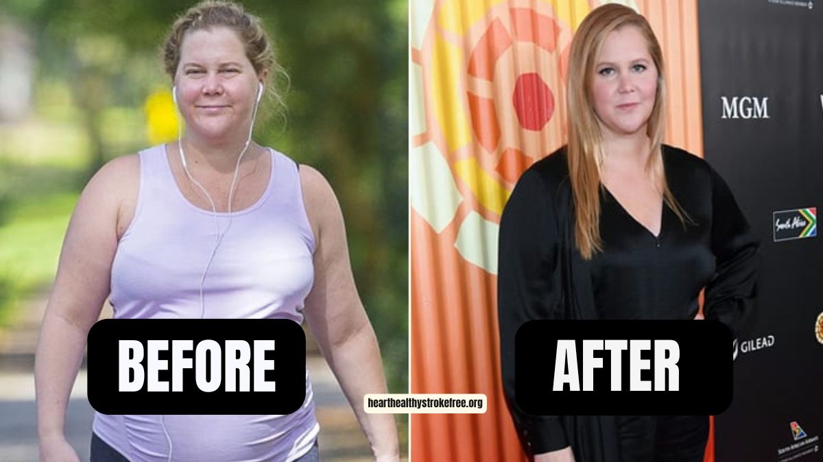 “Expecting Amy” Amy Schumer Weight Loss: 15 Pounds In 3 Months, 200 Pounds To 185 Pounds
