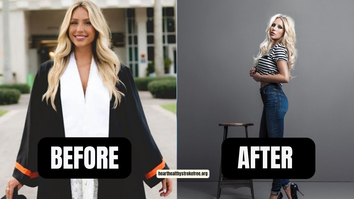 Alix Earle Weight Loss: 9 Pounds In 2023, From 130 Pounds To 121 Pounds – A Journey Of Health And Transformation