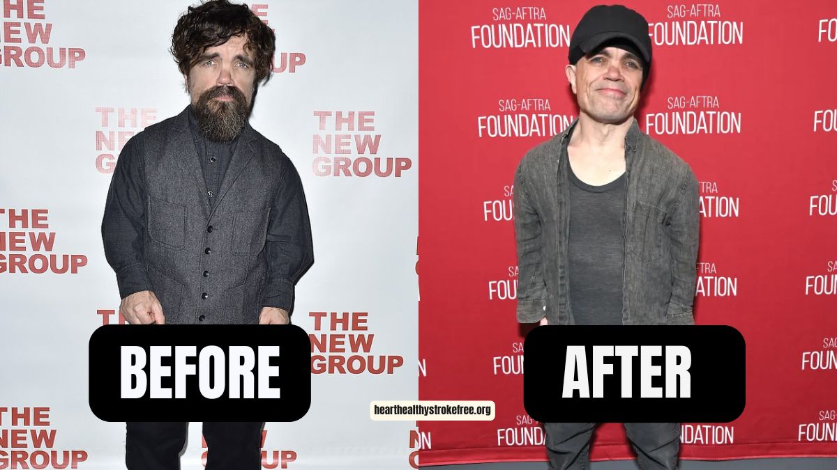 ”Game of Thrones“ Peter Dinklage Weight Loss: From 275 Pounds to 230 Pounds in 2023, A 45-Pound Transformation