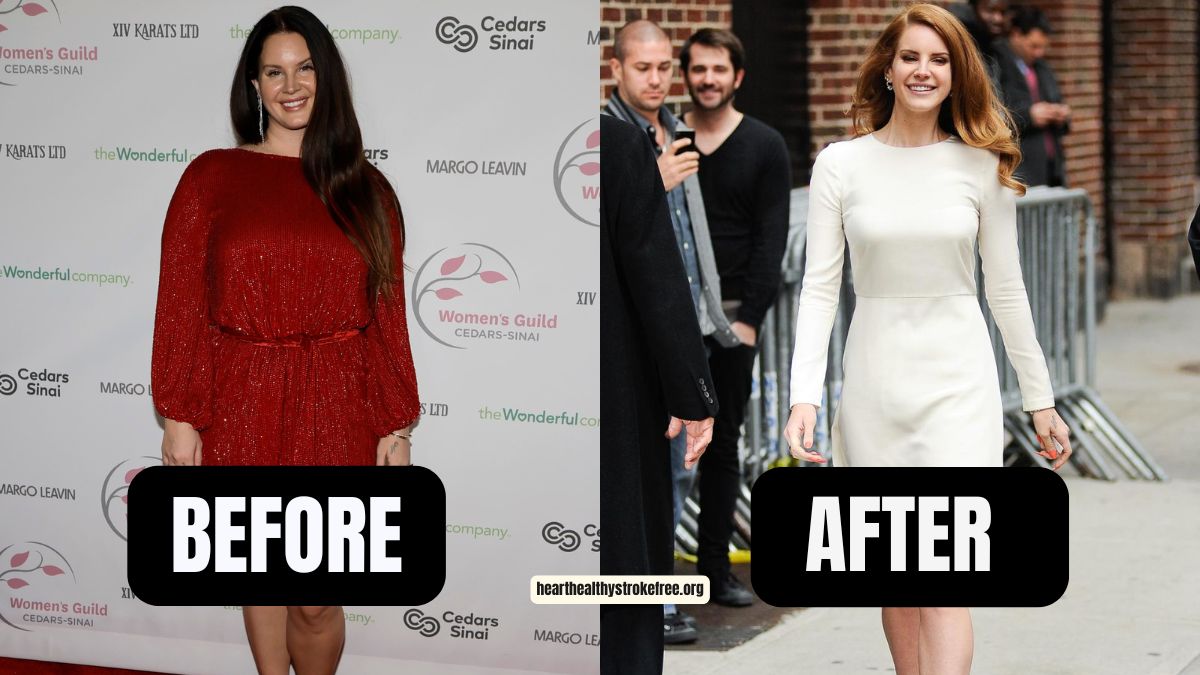 ”Blue Banisters“ Lana Del Rey’s Weight Loss Journey: 50 Pounds In One Year, From 200 To 150 Pounds, A Stunning Transformation