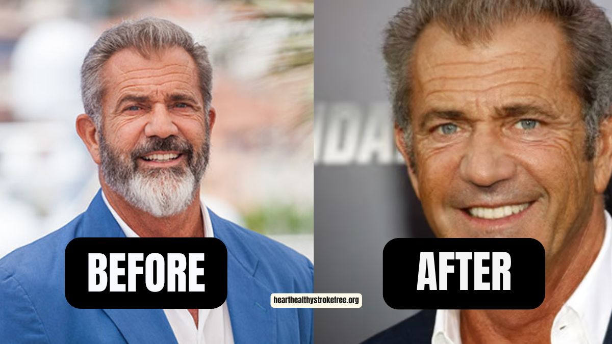 “Braveheart” Mel Gibson Weight Loss: 30 Pounds In 6 Months, From 210 Pounds To 180 Pounds