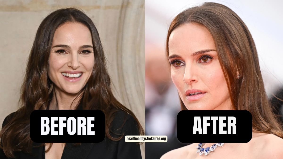“Black Swan” Natalie Portman Weight Loss: 20 Pounds In 6 Months, From 140 To 120 Pounds, A Stunning Transformation