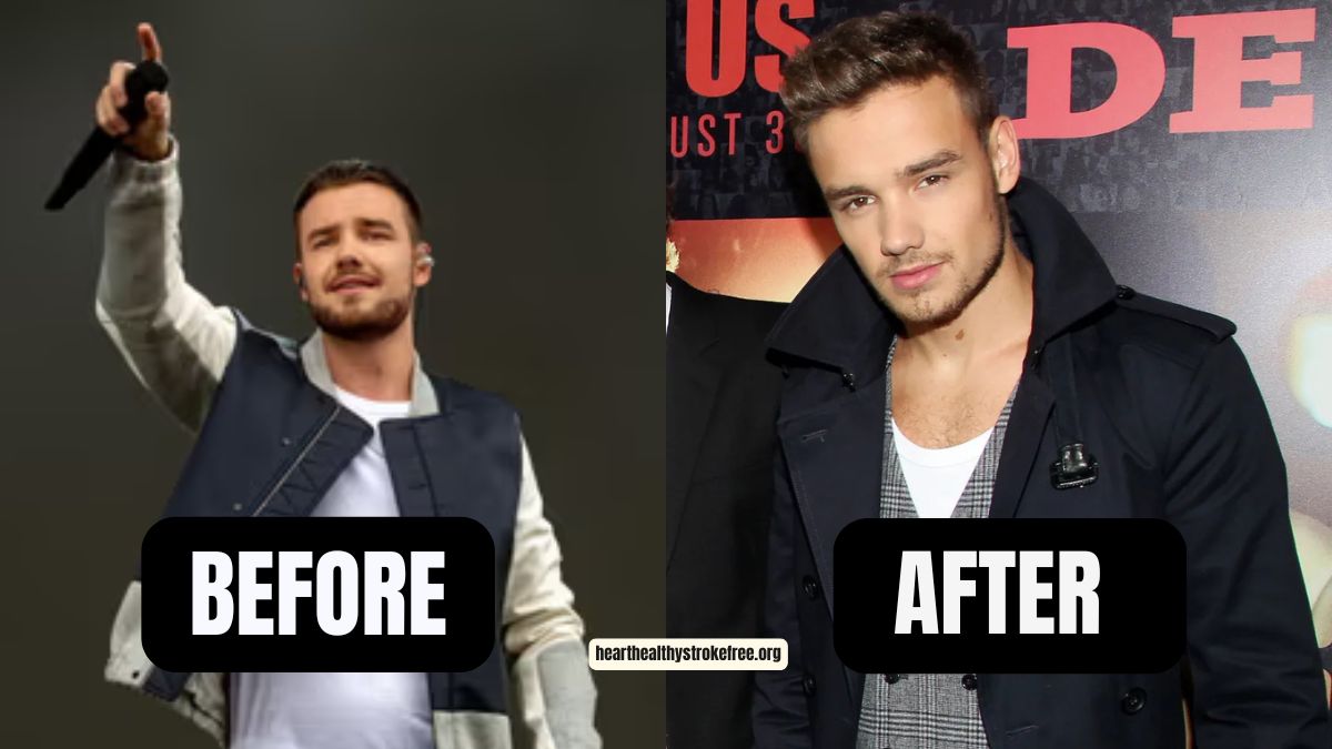 One Direction Liam Payne Weight Loss: Lost 40 Pounds In 2022, From 210 lbs To 170 lbs, A Complete Transformation