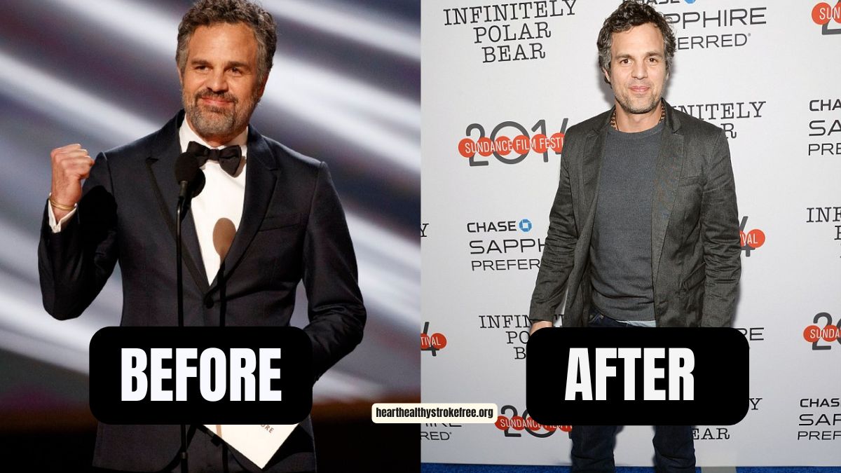 Mark Ruffalo Weight Loss- 20 Pounds In 6 Weeks, 1000-Calorie Diet, 500 Pushups A Day For I Know This Much Is True